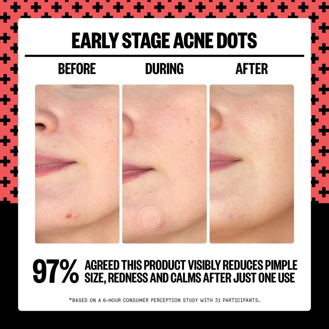 Peace Out 2% Salicylic Acid Early Stage Acne Dot - Imagen 3