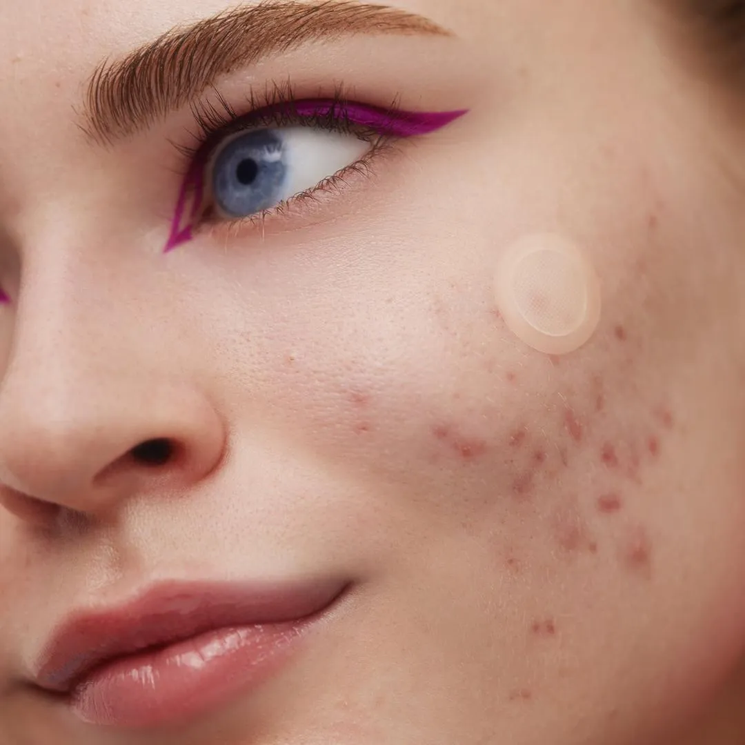Peace Out 2% Salicylic Acid Early Stage Acne Dot - Imagen 4